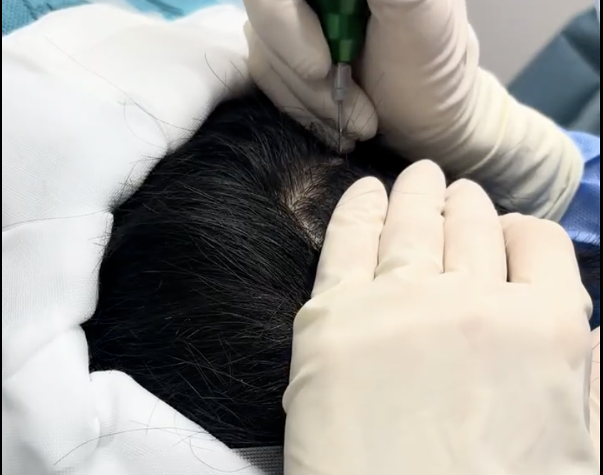 極細パンチとトリミング